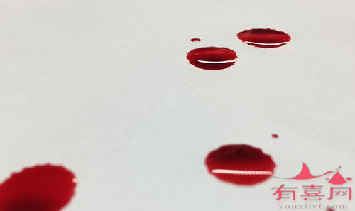 深圳供卵助孕医院排名-戒断出血是什么颜色，什么是正常的？